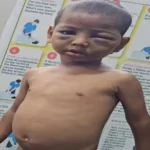 बब