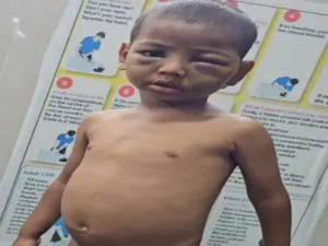 बब